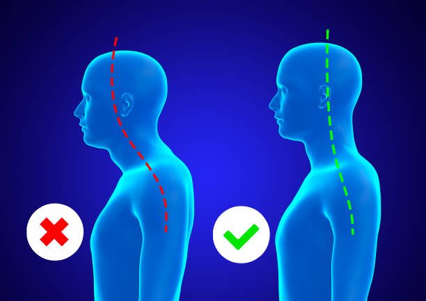 Posture Before and After — Rounded Shoulders